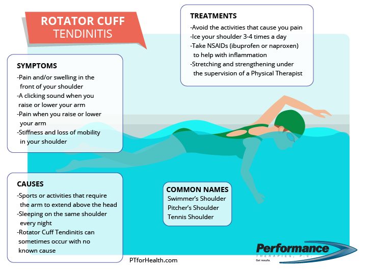 Rotator Cuff Tendinitis Infographic