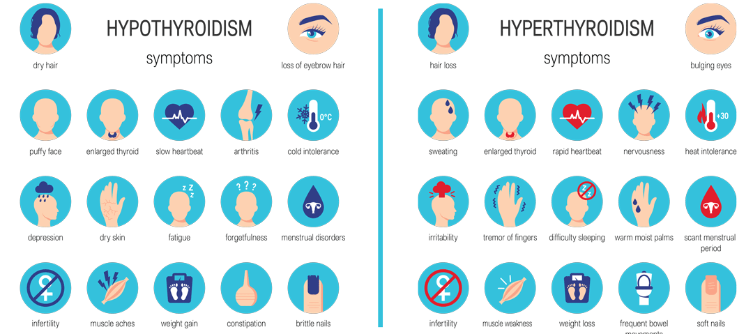 Thyroid Disorder Symptoms